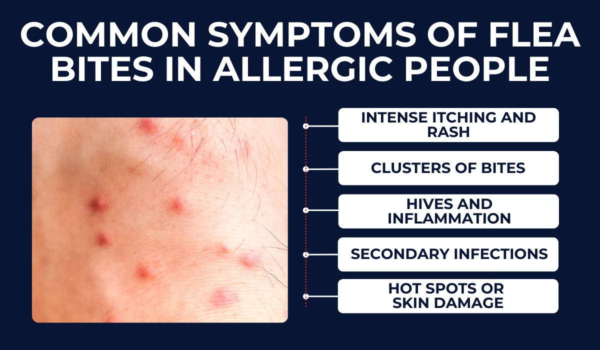 Common Symptoms Of Flea Bites In Allergic People
